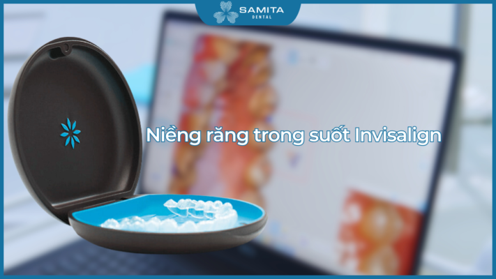 Niềng răng invisalign